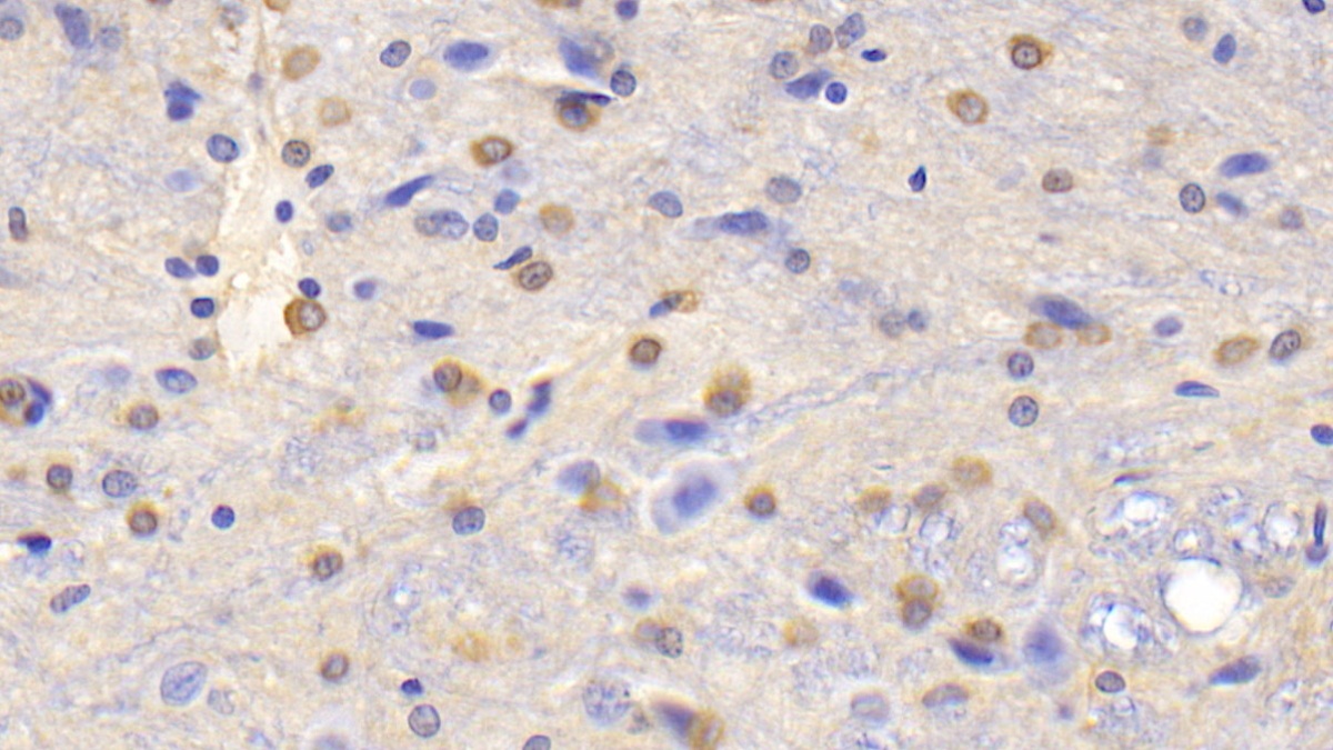 Polyclonal Antibody to Glutamine synthetase (GS)