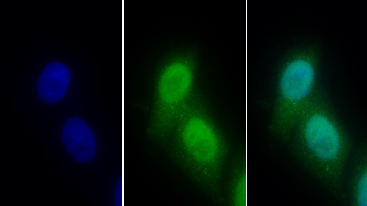 Polyclonal Antibody to High Mobility Group Protein 20B (HMG20B)