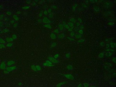 Polyclonal Antibody to Protein Disulfide Isomerase A4 (PDIA4)