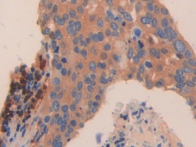 Polyclonal Antibody to Tryptase Delta 1 (TPSd1)