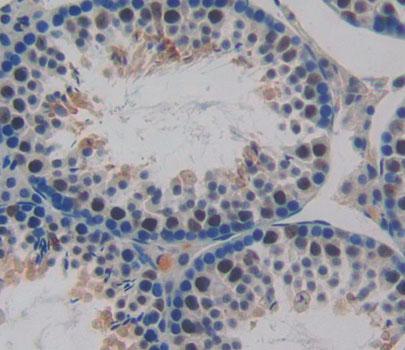 Polyclonal Antibody to Phospholipase C Delta 4 (PLCd4)