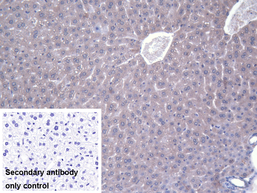 Polyclonal Antibody to Alanine Glyoxylate Aminotransferase 2 (AGXT2)