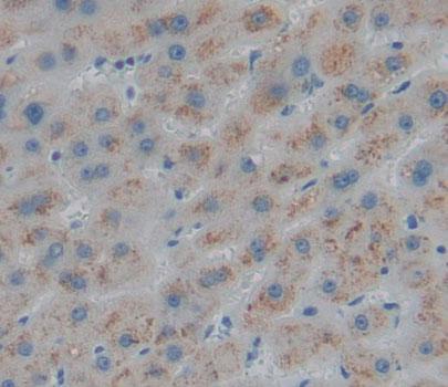 Polyclonal Antibody to 4-Aminobutyrate Aminotransferase (ABAT)