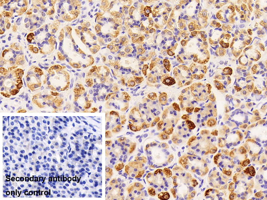 Polyclonal Antibody to Branched Chain Aminotransferase 2, Mitochondrial (BCAT2)