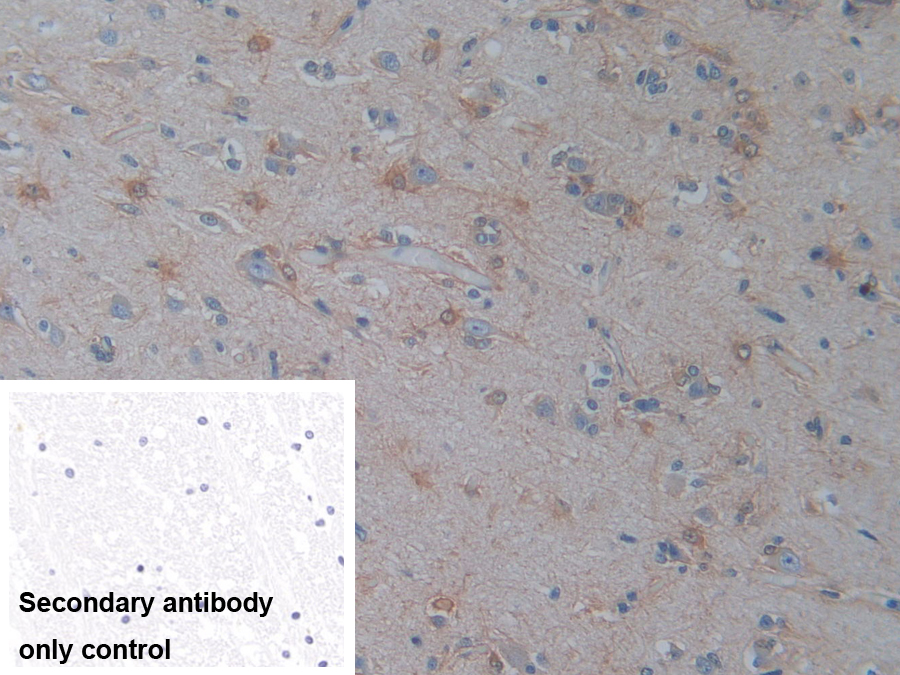 Polyclonal Antibody to Phosphoserine Aminotransferase 1 (PSAT1)