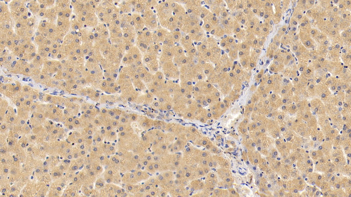 Polyclonal Antibody to Glutamine Fructose-6-Phosphate Transaminase 1 (GFPT1)