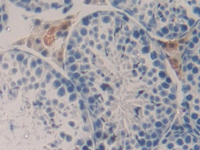 Polyclonal Antibody to Tumor Necrosis Factor Ligand Superfamily, Member 9 (TNFSF9)