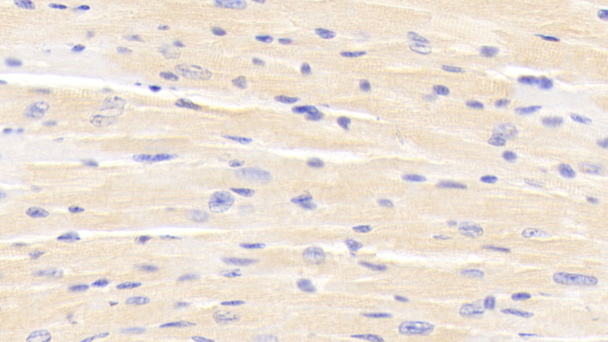 Polyclonal Antibody to Estrogen Related Receptor Beta (ERRb)