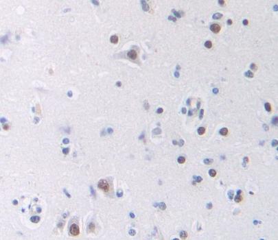 Polyclonal Antibody to Cyclic AMP Response Element Binding Protein 5 (CREB5)