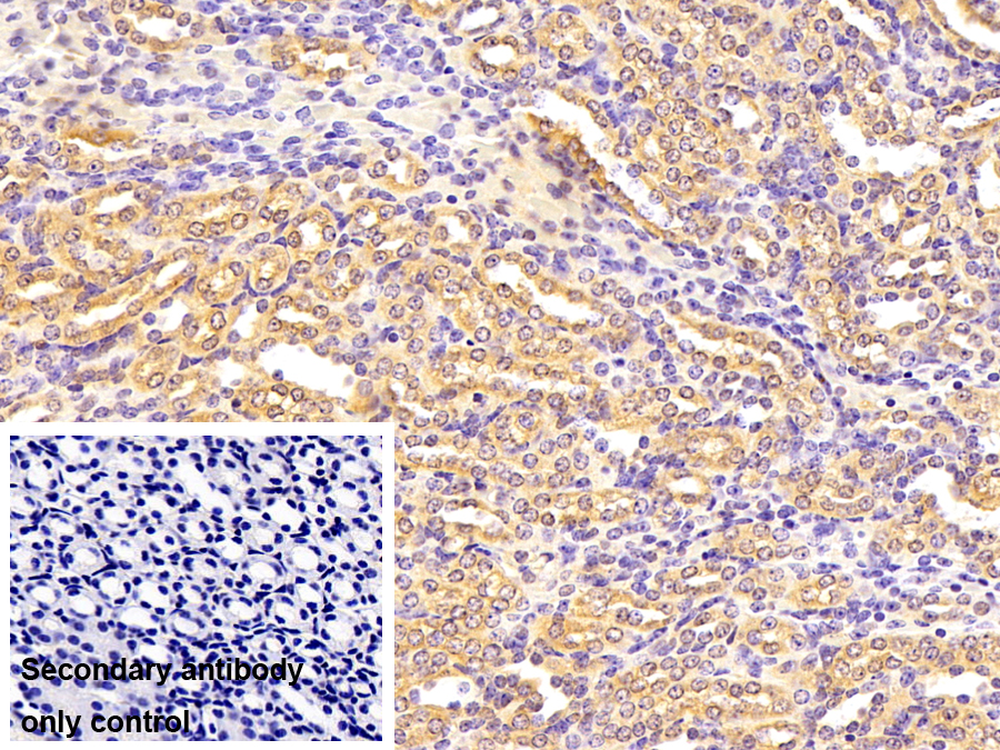 Polyclonal Antibody to Cannabinoid Receptor Interacting Protein 1 (CNRIP1)