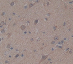 Polyclonal Antibody to Baculoviral IAP Repeat Containing Protein 6 (BIRC6)