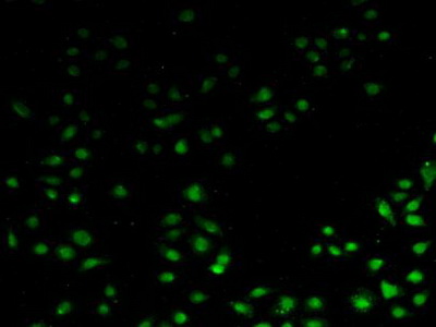 Polyclonal Antibody to Apoptosis Inhibitor 5 (API5)