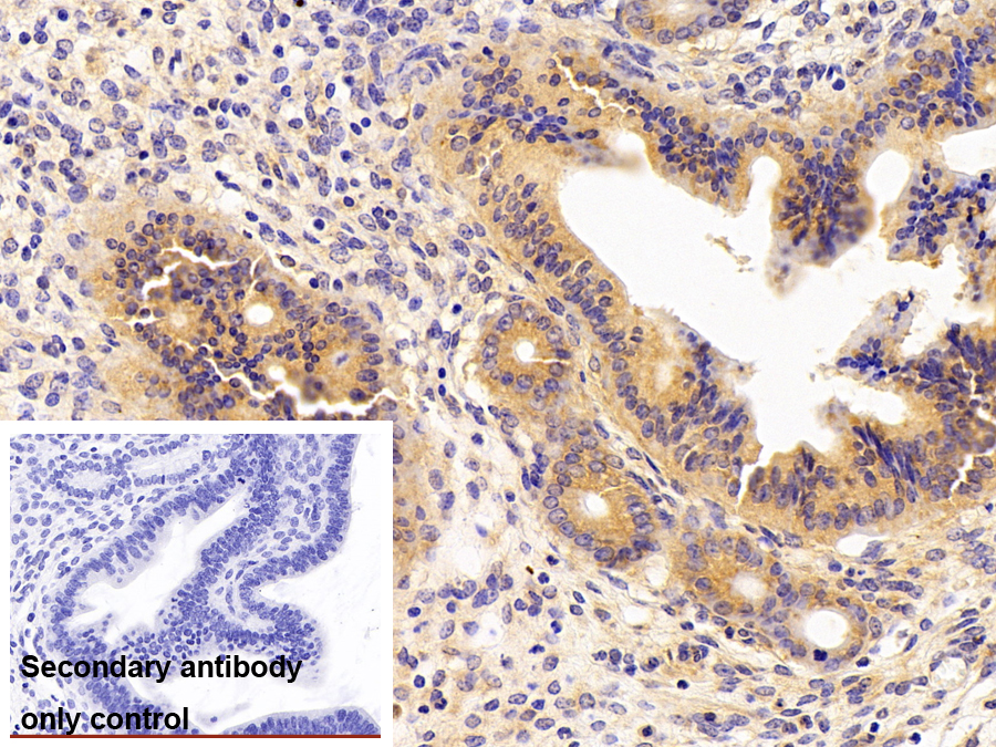 Polyclonal Antibody to Prolyl-4-Hydroxylase Alpha Polypeptide II (P4Ha2)