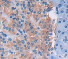 Polyclonal Antibody to Procollagen Lysine-2-Oxoglutarate-5-Dioxygenase 2 (PLOD2)