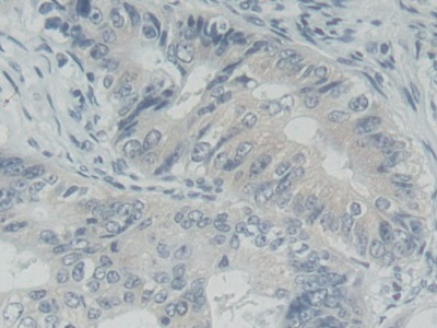 Polyclonal Antibody to Receptor Tyrosine Kinase Like Orphan Receptor 2 (ROR2)