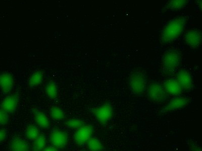 Polyclonal Antibody to Protein Tyrosine Kinase 6 (PTK6)