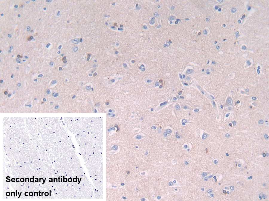 Polyclonal Antibody to Neural Cell Adhesion Molecule 2 (NCAM2)