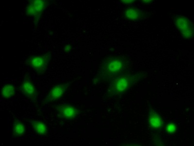 Polyclonal Antibody to Alpha-1-B-Glycoprotein (a1BG)