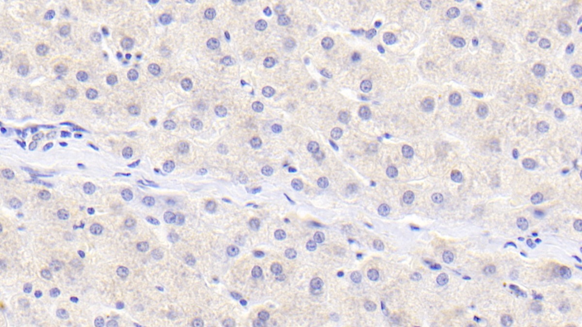 Polyclonal Antibody to Protein Inhibitor Of Activated STAT 3 (PIAS3)