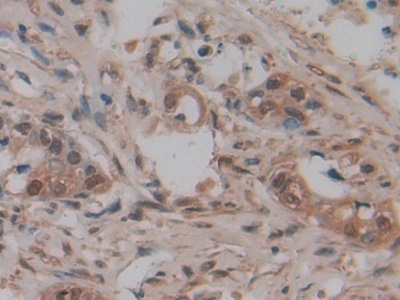 Polyclonal Antibody to Minichromosome Maintenance Deficient 5 (MCM5)