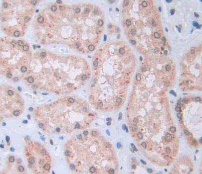 Polyclonal Antibody to Collapsin Response Mediator Protein 5 (CRMP5)