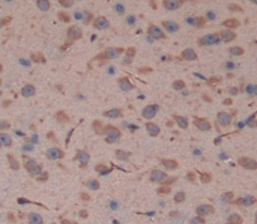 Polyclonal Antibody to Fascin 2 (FSCN2)