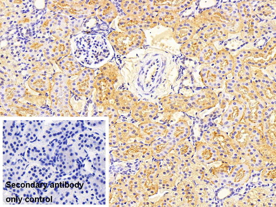 Polyclonal Antibody to Sphingosine Kinase 1 (SPHK1)