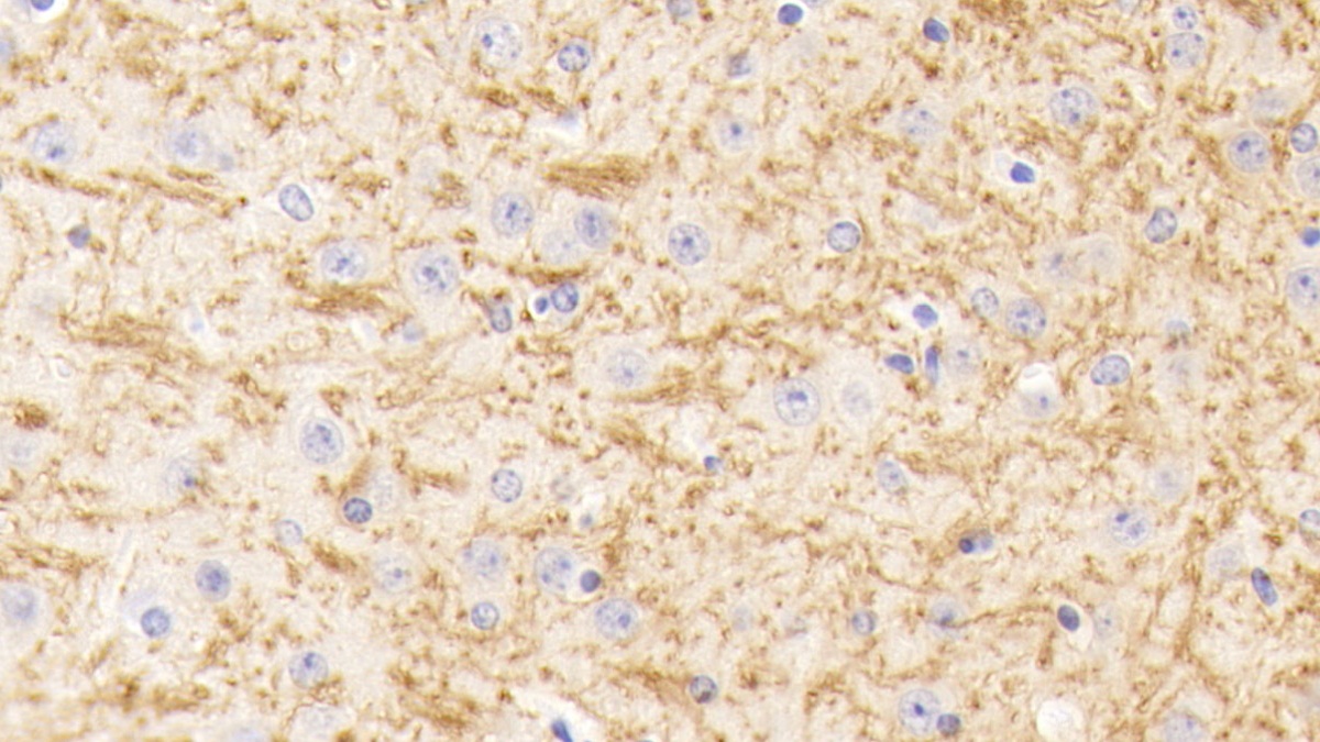 Polyclonal Antibody to Tubulin Beta 1 (TUBb1)