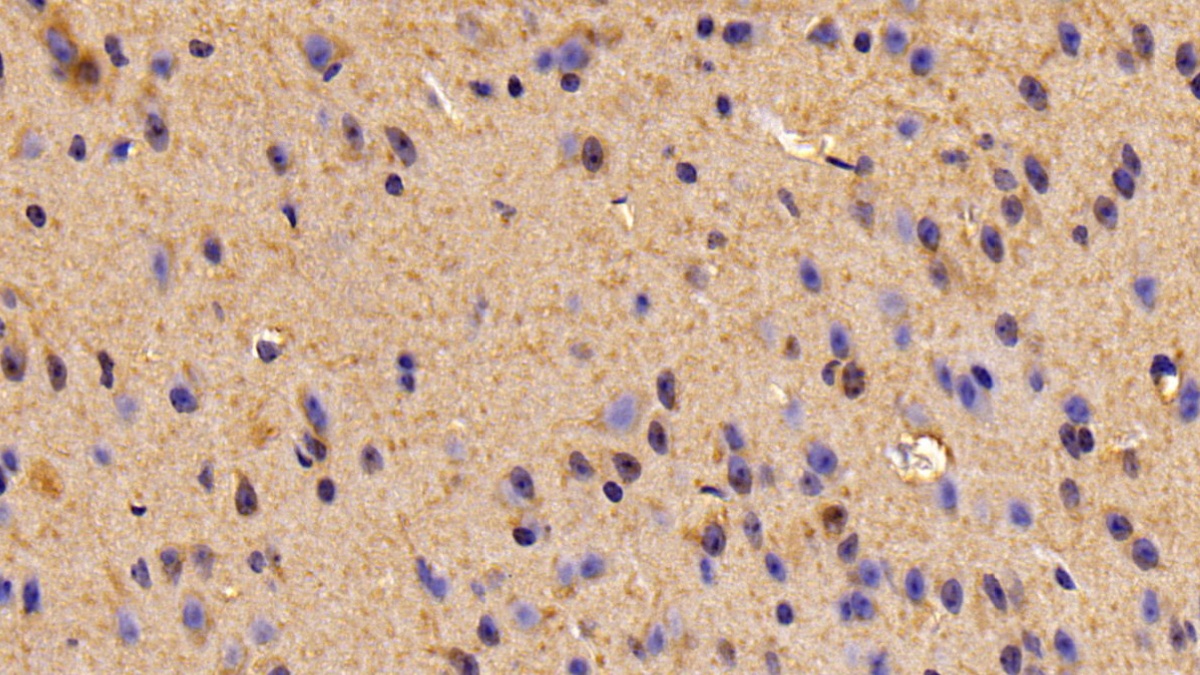 Polyclonal Antibody to Tubulin Beta 6 (TUBb6)