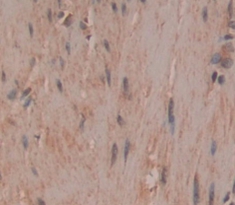 Polyclonal Antibody to Tau-Tubulin Kinase 2 (tTBK2)