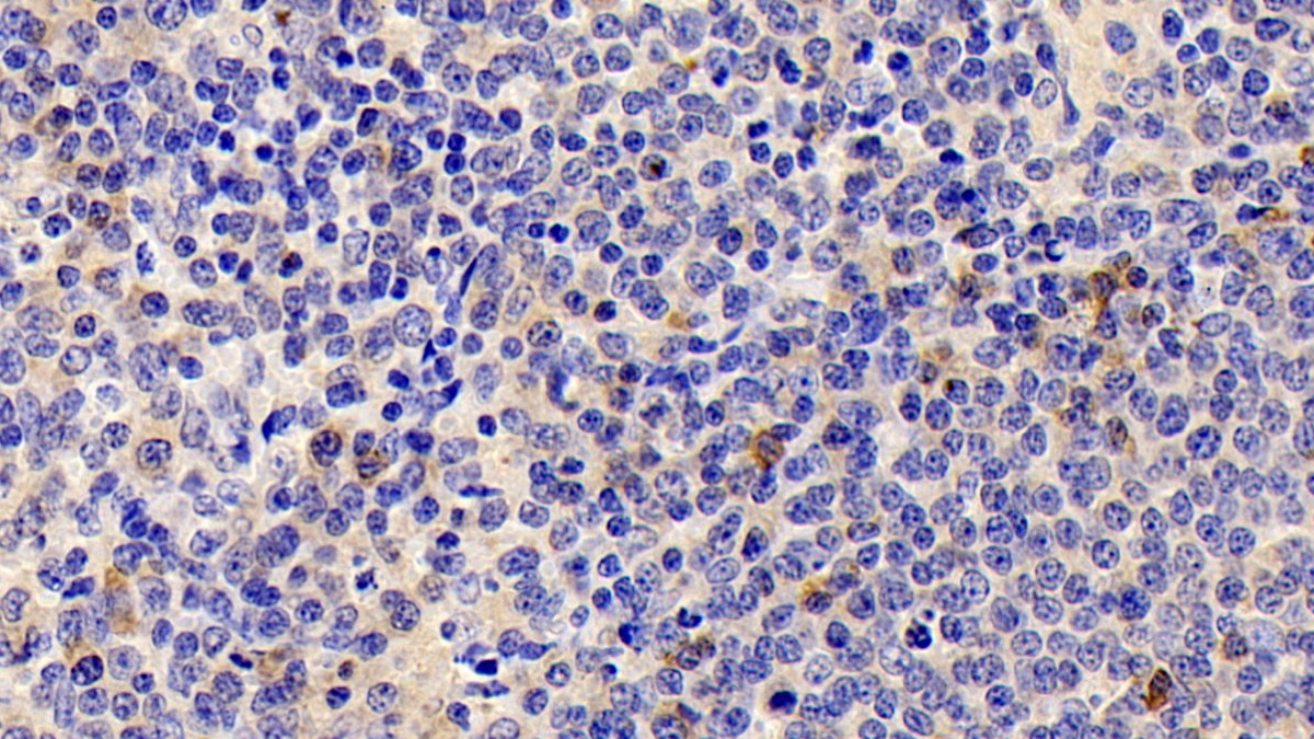 Polyclonal Antibody to Interleukin 22 Receptor (IL22R)