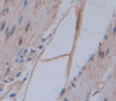 Polyclonal Antibody to Annexin A3 (ANXA3)