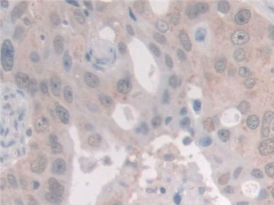 Polyclonal Antibody to Nuclear Receptor Coactivator 3 (NCOA3)