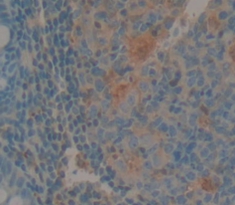 Polyclonal Antibody to Interleukin 1 Epsilon (IL1e)