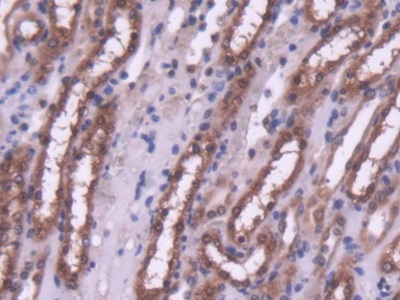 Polyclonal Antibody to Histone Deacetylase 4 (HDAC4)