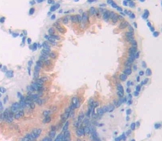 Polyclonal Antibody to Sirtuin 1 (SIRT1)