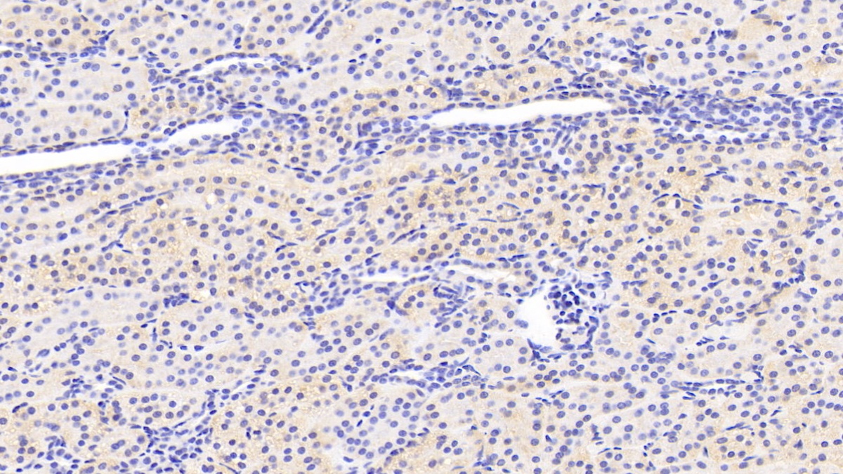 Polyclonal Antibody to Sirtuin 3 (SIRT3)