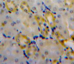 Polyclonal Antibody to Chloride Intracellular Channel Protein 4 (CLIC4)