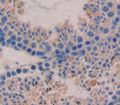 Polyclonal Antibody to Cysteine Rich Secretory Protein 2 (CRISP2)