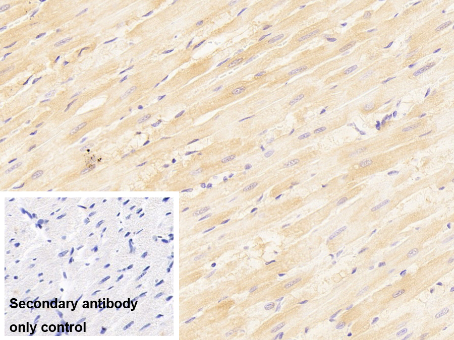 Polyclonal Antibody to Heat Shock Protein Beta 6 (HSPb6)