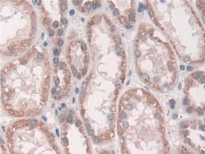 Polyclonal Antibody to Growth Factor Receptor Bound Protein 10 (Grb10)