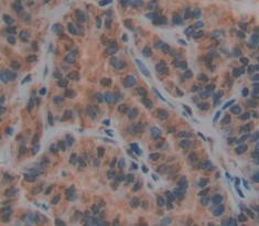 Polyclonal Antibody to Histatin 1 (HTN1)