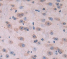 Polyclonal Antibody to Kinesin Family, Member 5A (KIF5A)