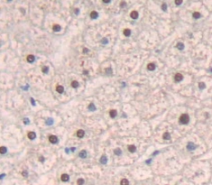 Polyclonal Antibody to Lamin A/C (LMNA)