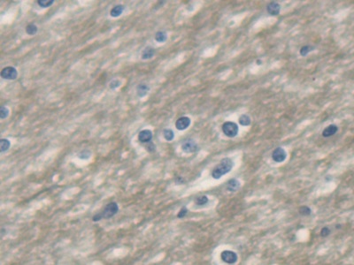 Polyclonal Antibody to Uncoupling Protein 1, Mitochondrial (UCP1)