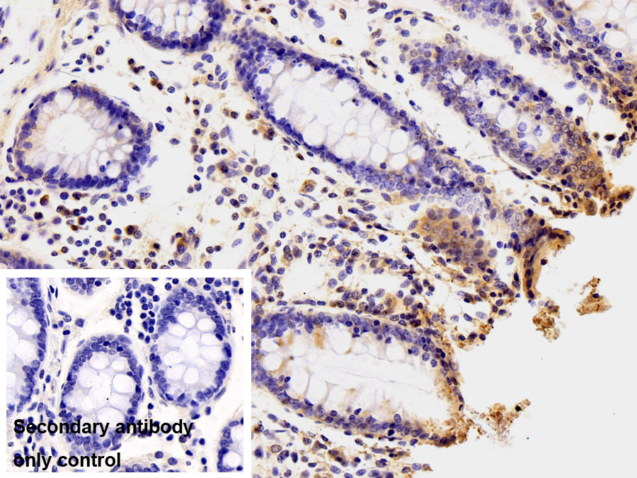 Polyclonal Antibody to Phosphodiesterase 4D, cAMP Specific (PDE4D)