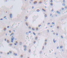 Polyclonal Antibody to Nuclear Factor I/B (NFIB)