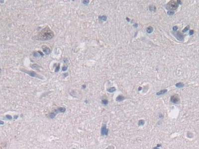 Polyclonal Antibody to 2',5'-Oligoadenylate Synthetase 2 (OAS2)
