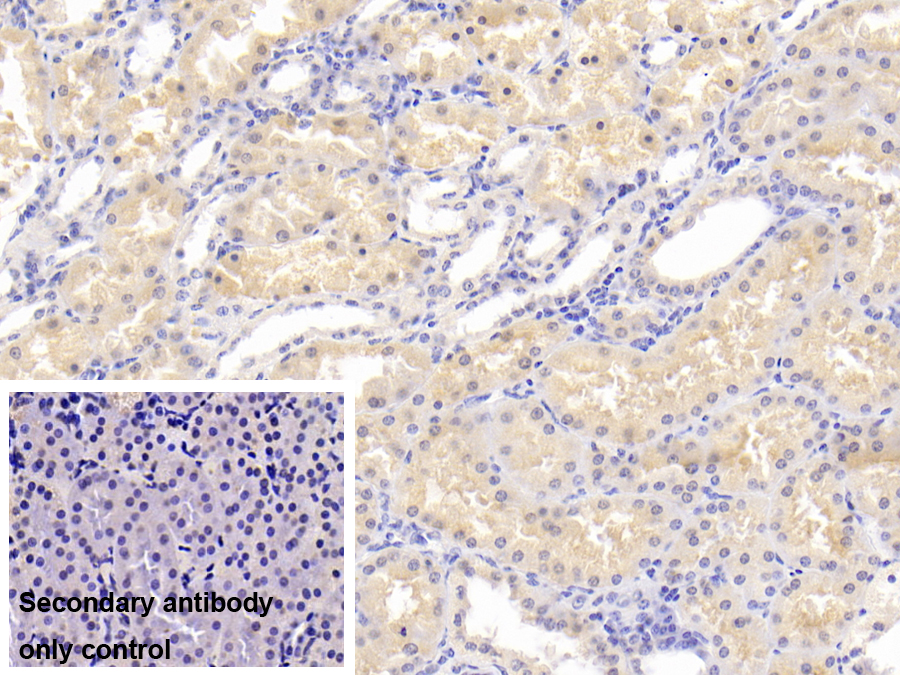 Polyclonal Antibody to Peptidyl Arginine Deiminase Type II (PADI2)