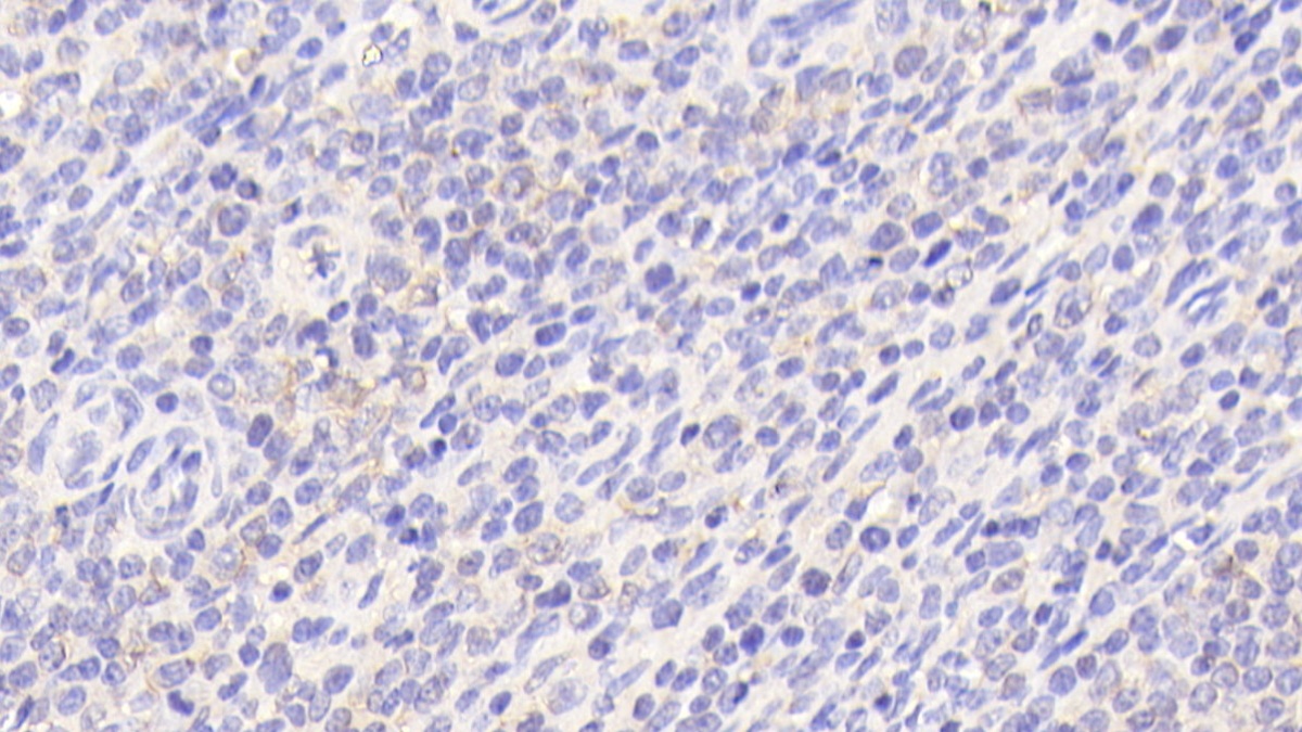 Polyclonal Antibody to Polymerase DNA Directed Gamma 1 (POLg1)